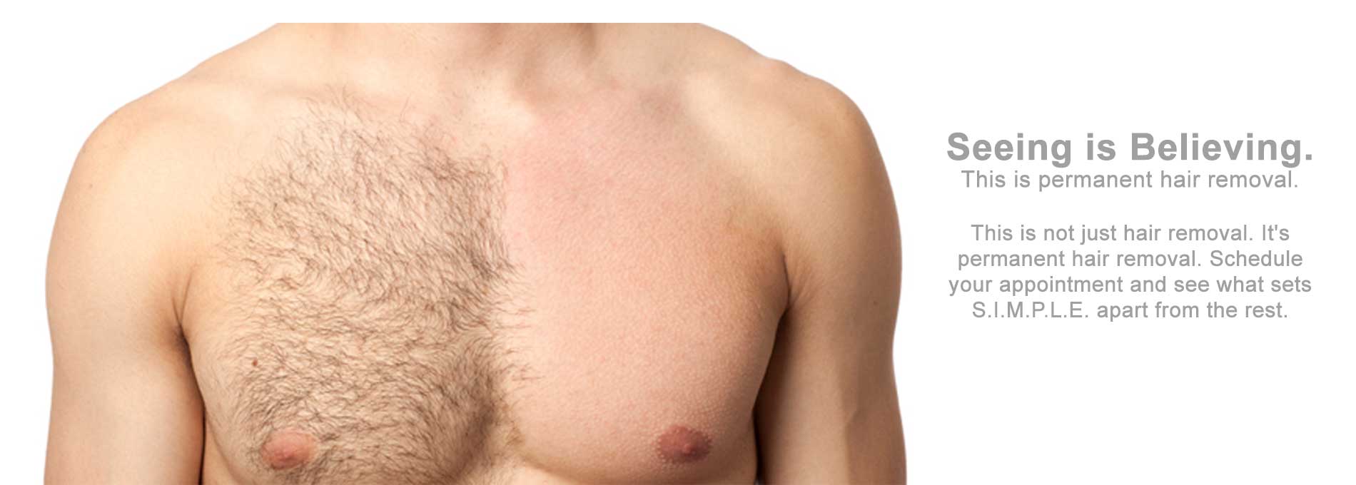 Permanent Hair Removal S I M P L E Hair Removal Electrolysis Of
